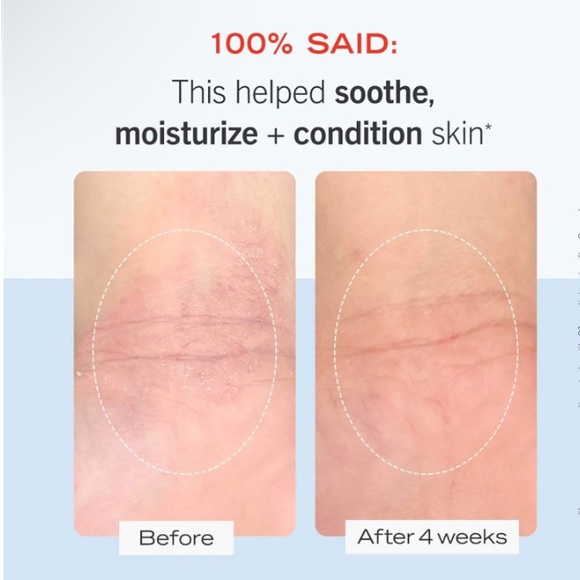 First Aid Beauty Ultra Repair Cream Intense Hydration 8oz - Picture 2 of 4